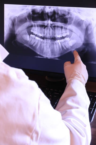 Best Emergency Tooth Extraction in Norridge, IL