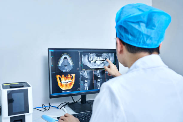 Best Emergency Wisdom Teeth Removal in Norridge, IL